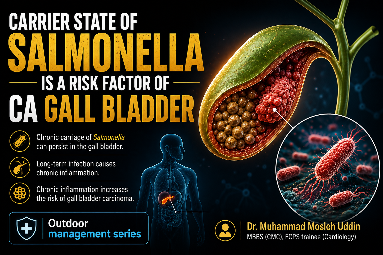 Carrier state of Salmonella is a risk factor of Ca gall bladder (adenocarcinoma)