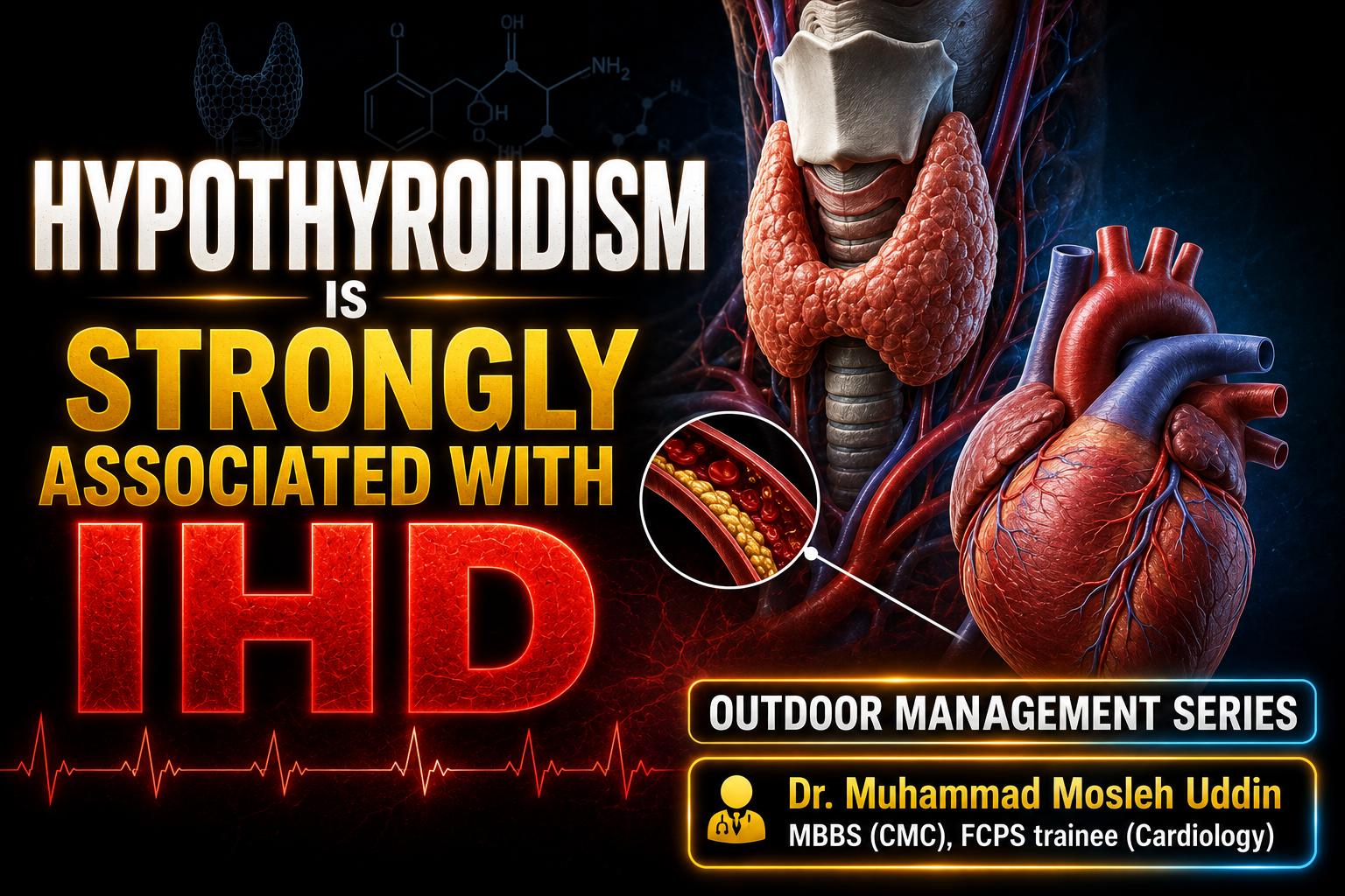 Hypothyroidism is strongly associated with IHD