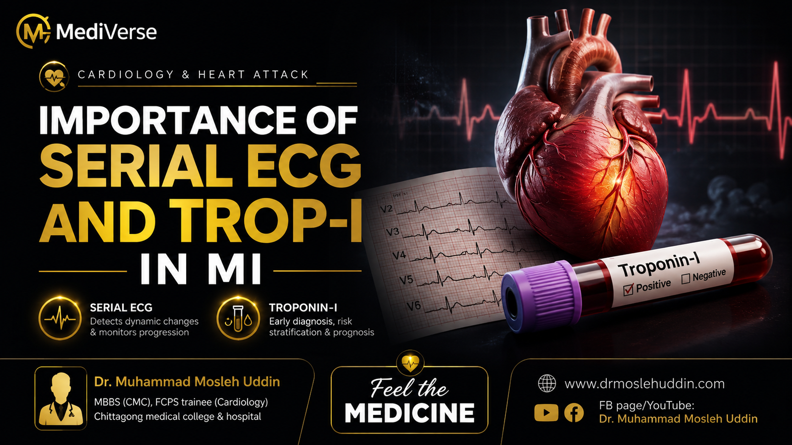 Importance of serial ECG & Trop-I in MI